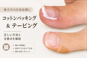 巻き爪の応急処置に コットンパッキング＆テーピング 正しい方法と注意点を解説
