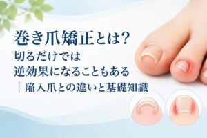 巻き爪矯正とは？