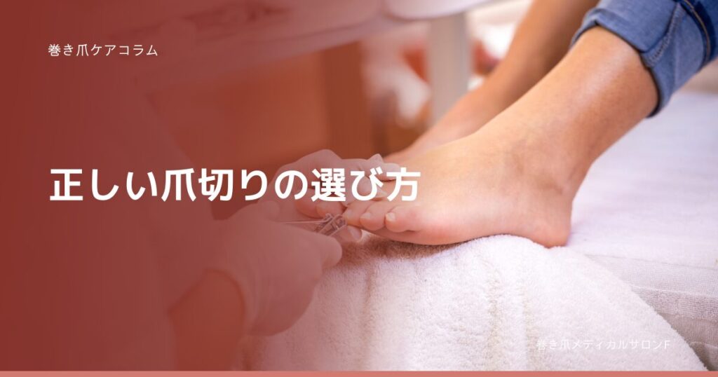 巻き爪ケアコラム 正しい爪切りの選び方