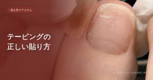 巻き爪ケアコラム テーピングの正しい貼り方